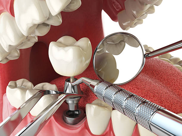Best Orthodontic Emergency Dentist in Crescent Springs, KY